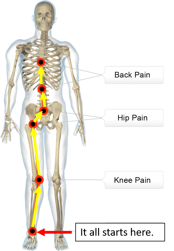 secondary orthopedic deformities that are caused by the partial dislocation of the ankle bone