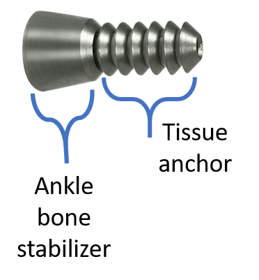 HyProCure sinus tarsi implant with parts description