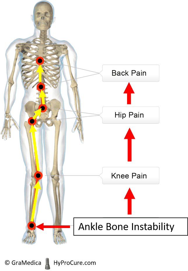Stable Ankle Bone and Ankle Bone Instability comparison